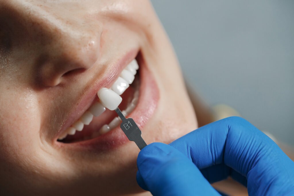 Fixed artificial teeth treatment using dental crowns and bridges